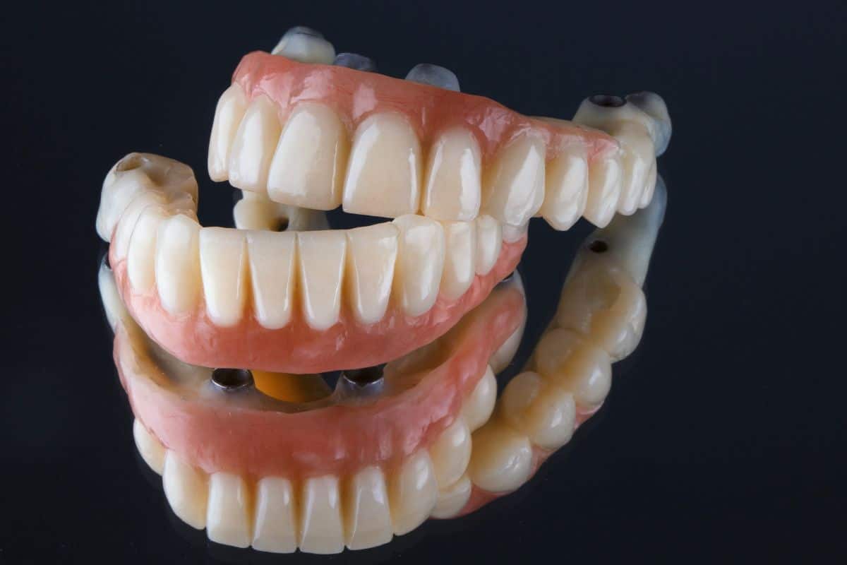 What Do All-On-4 Implants Feel Like All-On-4 implant