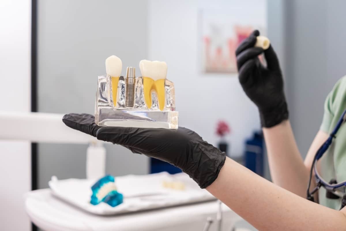 Dental Implants Dental Implants-EL Paso