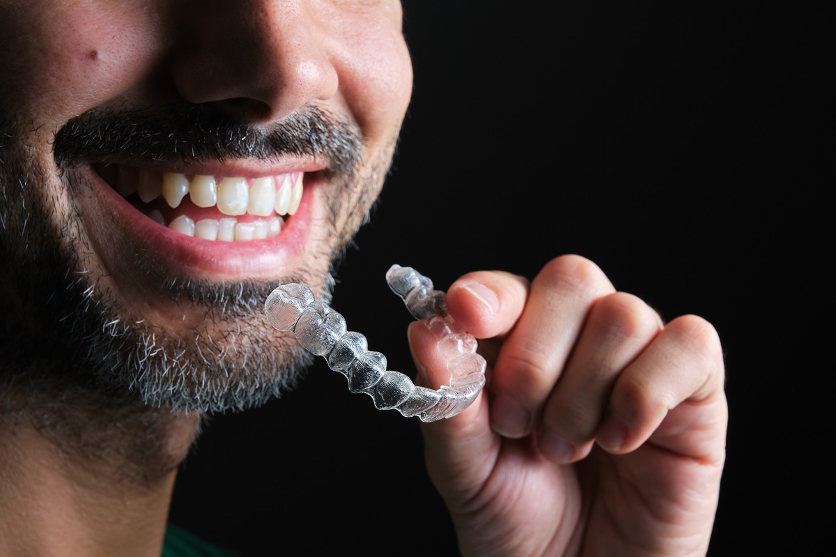 Invisalign before and after 6 months el paso TX