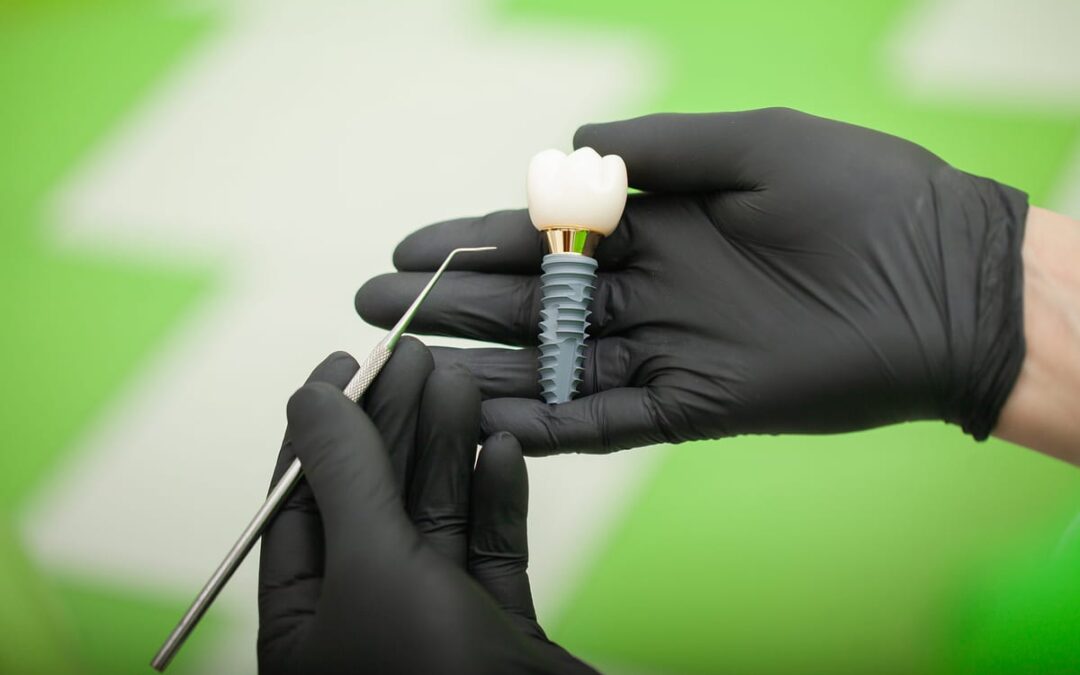 Is Your Jaw Shifting? 5 Signs You’ve Waited Too Long for Implants