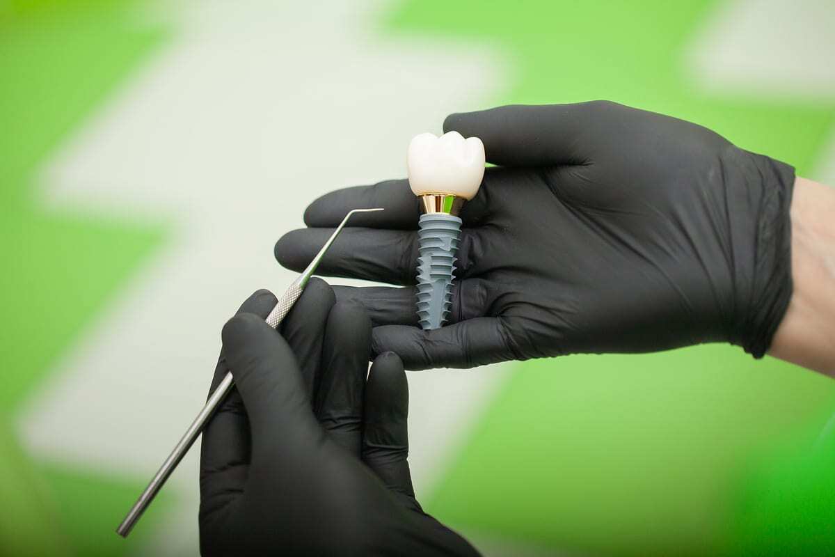 All On X Implants in El Paso Dentist holding dental implant model with crown and screw components.