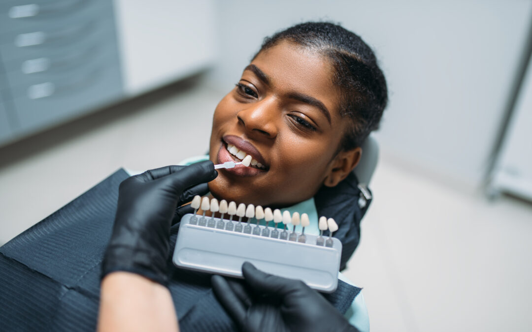 Porcelain vs. Composite Veneers: Which Lasts Longer and Costs Less